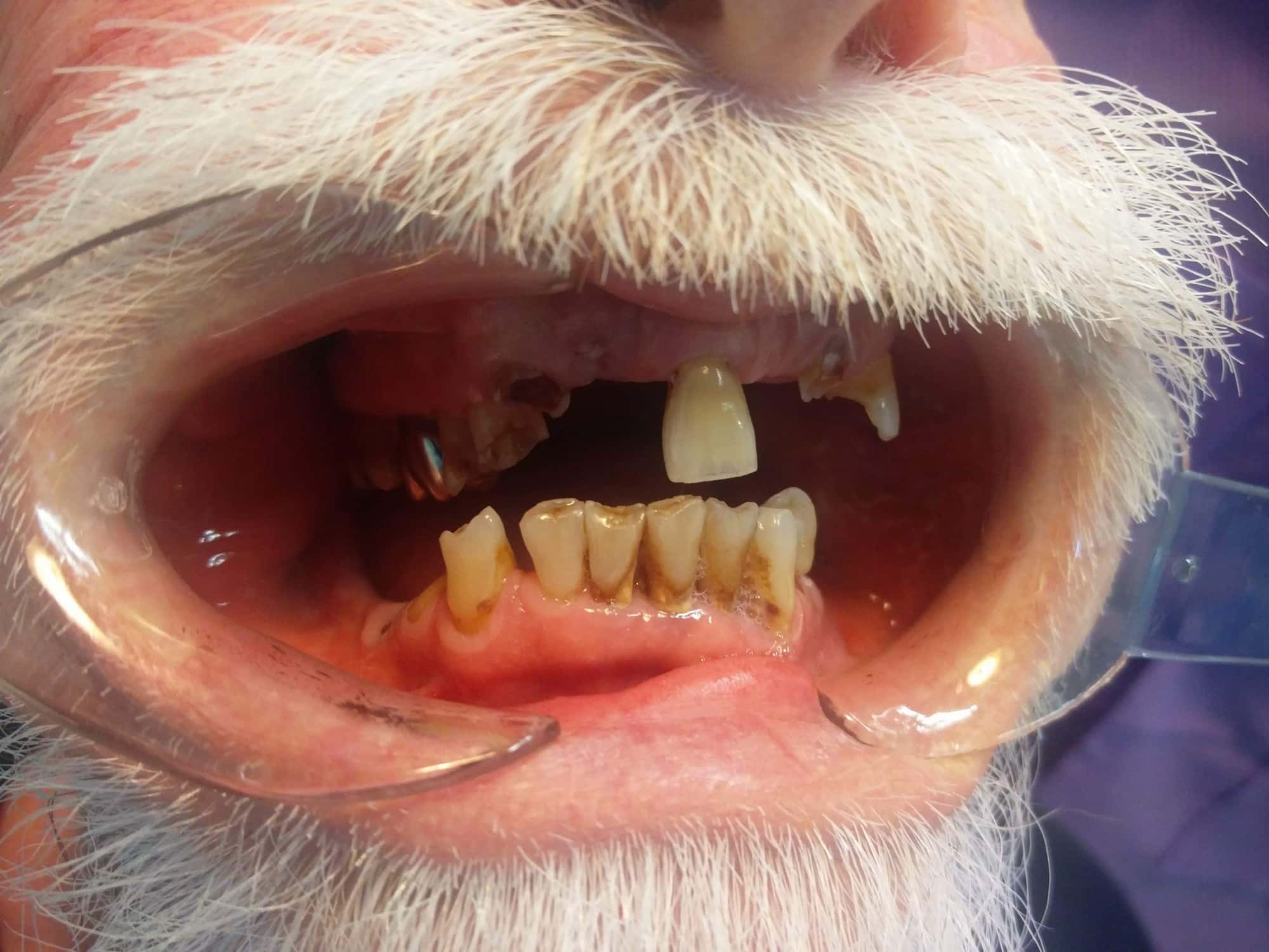 DentalIMG_20180609_103302