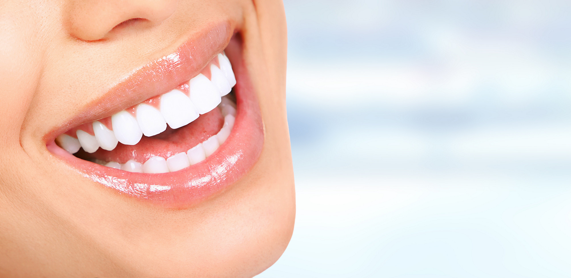 TEETH WHITENING IN El CAJON - Dental Arts San Diego