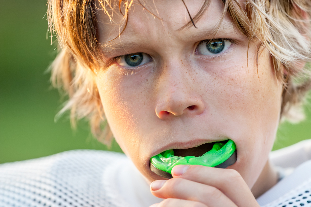 Custom Mouth Guards vs. Store Bought