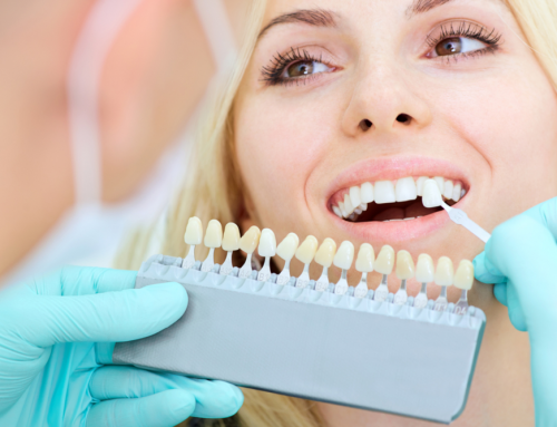 Everything You Need to Know Before Getting A Dental Crown