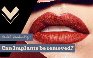 Can Implants be Removed