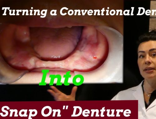 Turning a Conventional Denture Into a “Snap On” Denture