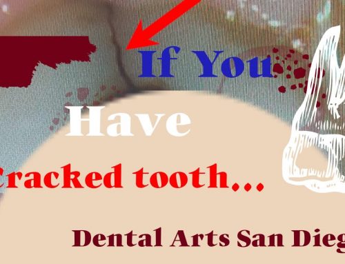 If you Have a Cracked Tooth in Your Mouth….