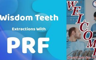 Wisdom Teeth Removal with PRF