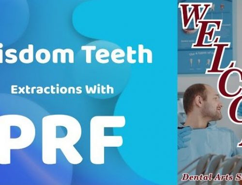 Wisdom Teeth Removal with PRF