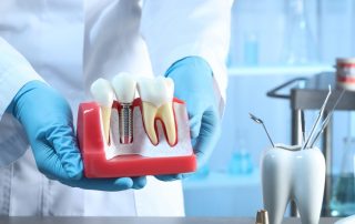 How to Avoid Common Dental Implant Problems