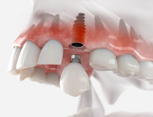 Risks Associated With Implants or the Implant Process