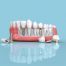 The Benefits of Dental Implants Over Traditional Dentures