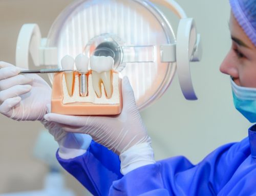 Summer Tips for Ensuring Proper Care of Your Dental Implants