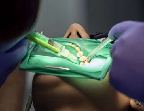 Can a Root Canal Save Your Tooth from Extraction?