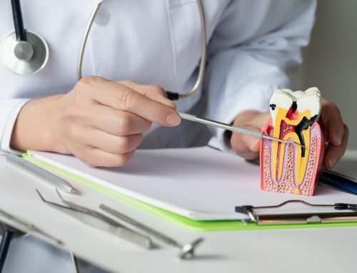 Common Signs and Symptoms that You Need a Root Canal