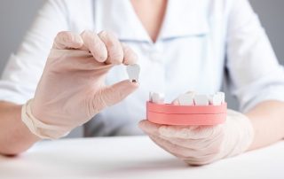 Are Dental Implants the Best Option for Missing Teeth?