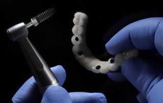 How Many Teeth Are Replaced with All-on-4 Dental Implants?