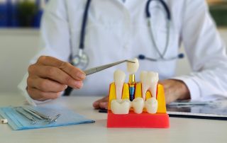 Why Dental Implants are a Gold Standard for Tooth Replacement