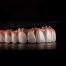What If I Do Not Want to Replace All My Teeth on the Arch?