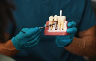 How Do Dental Implants Work?