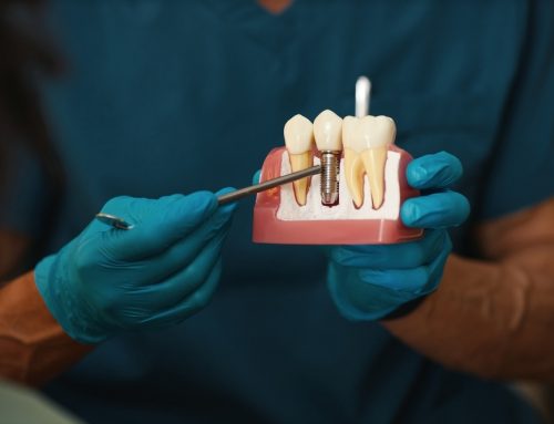 How Do Dental Implants Work?