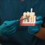 How Do Dental Implants Work?