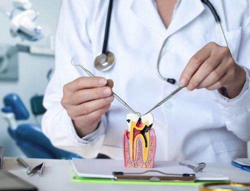 What Happens If You Don’t Get a Root Canal?