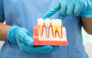 How Dental Implants Impact My Overall Health