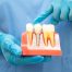 How Dental Implants Impact My Overall Health
