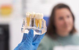 How Dental Implants Improve Chewing and Speaking Functionality