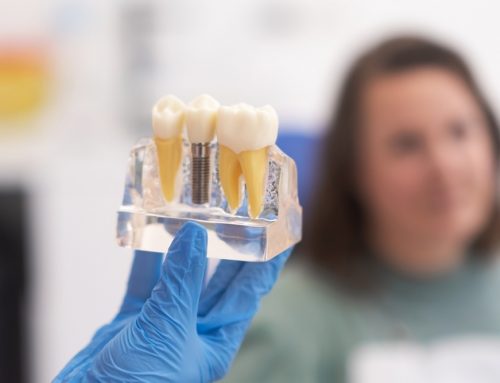 How Dental Implants Improve Chewing and Speaking Functionality