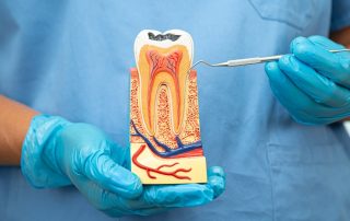 What Are the Benefits of Saving a Tooth with a Root Canal