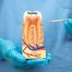 What Are the Benefits of Saving a Tooth with a Root Canal