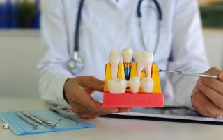 Why Dental Implants Are a Gold Standard for Tooth Replacement