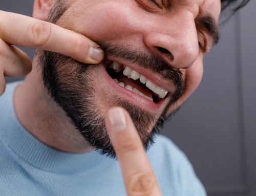 The True Cost of Missing Teeth: Why Investing in Dental Implants Pays Off