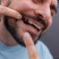 The True Cost of Missing Teeth: Why Investing in Dental Implants Pays Off