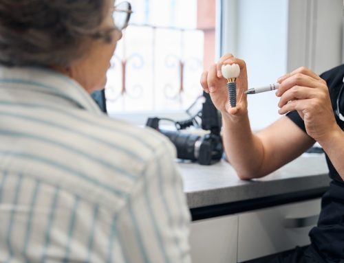 When to Consider Dental Implants: What You Should Know First