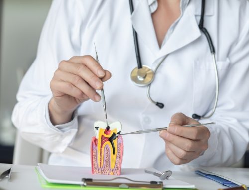 Why Combining Root Canal Treatment with Cosmetic Restoration Enhances Smile Results