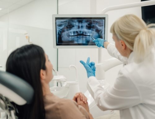 Why Dental Implants Are Less Painful Than You Think