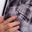Why Dental Implants Are the Most Permanent Solution for Missing Teeth