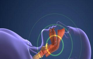 Why Early Detection of Sleep Apnea through Dentistry Improves Your Health
