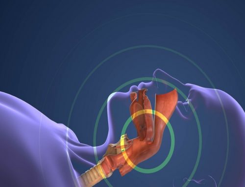 Why Early Detection of Sleep Apnea through Dentistry Improves Your Health