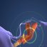Why Early Detection of Sleep Apnea through Dentistry Improves Your Health