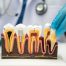 How Do Root Canals Save Your Natural Teeth?
