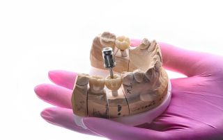 Bone Grafting for Dental Implants: Why It May Be Necessary