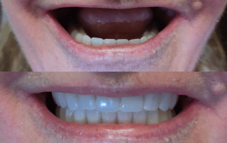 Dental Arts - From a Gummy Grin to a Glamorous Smile