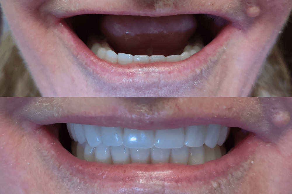 Dental Arts - From a Gummy Grin to a Glamorous Smile