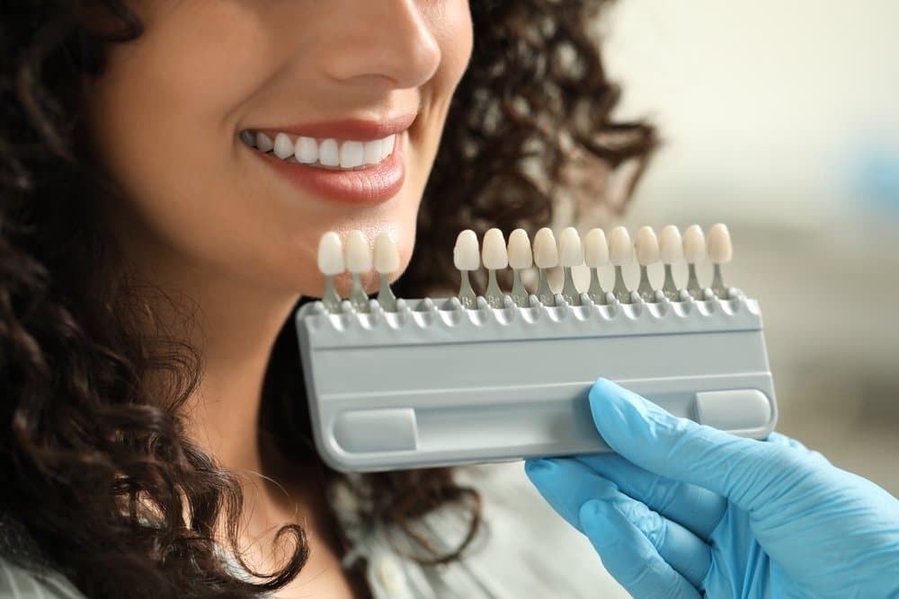 How Porcelain Veneers Improve the Look of Chipped or Stained Teeth