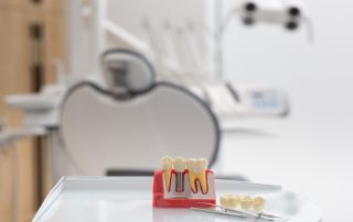 What to Expect During the Dental Implant Process