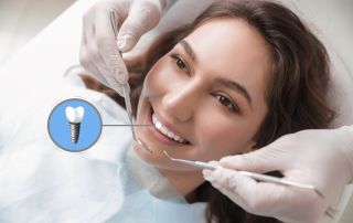 5 Ways Dental Implants Change Your Daily Life