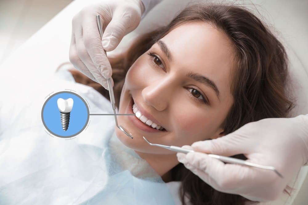 5 Ways Dental Implants Change Your Daily Life