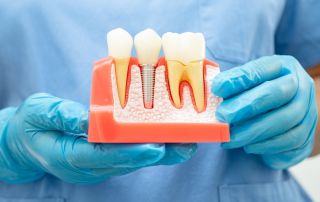 How Dental Implants Help Restore Your Smile and Bite Function