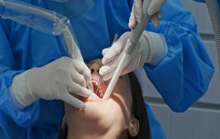 When Root Planing Is Needed to Treat Early Gum Disease