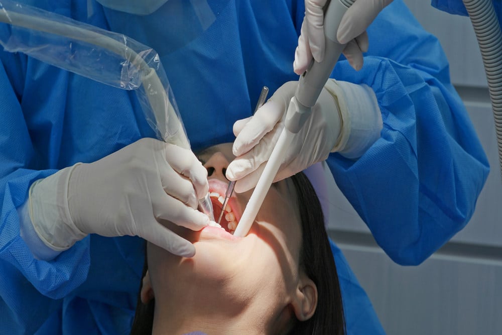 When Root Planing Is Needed to Treat Early Gum Disease